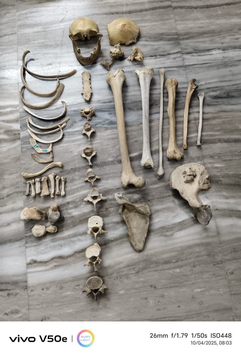 Bone Set