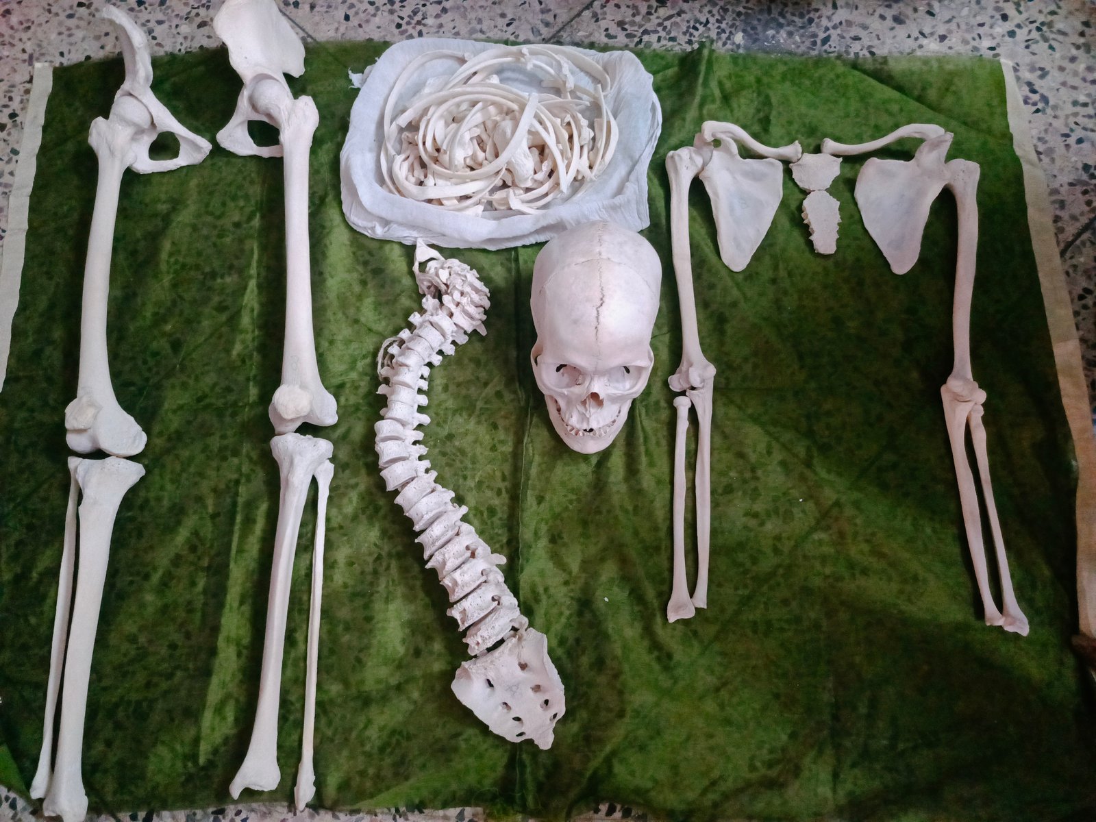 Bilateral Bone Set