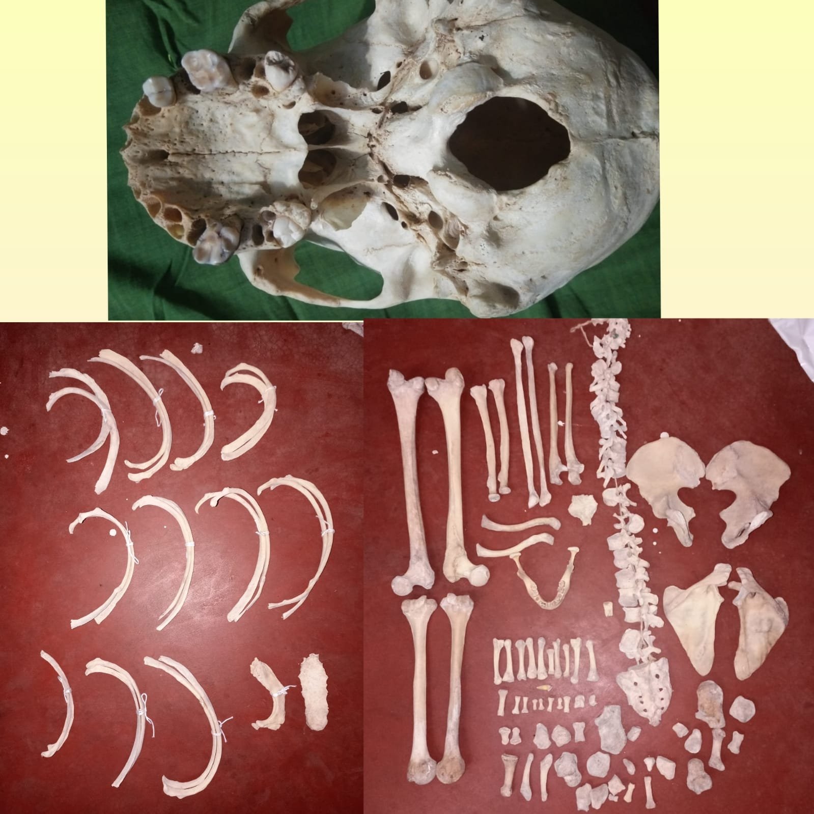 complete bilaterial bonesent with articulated skull