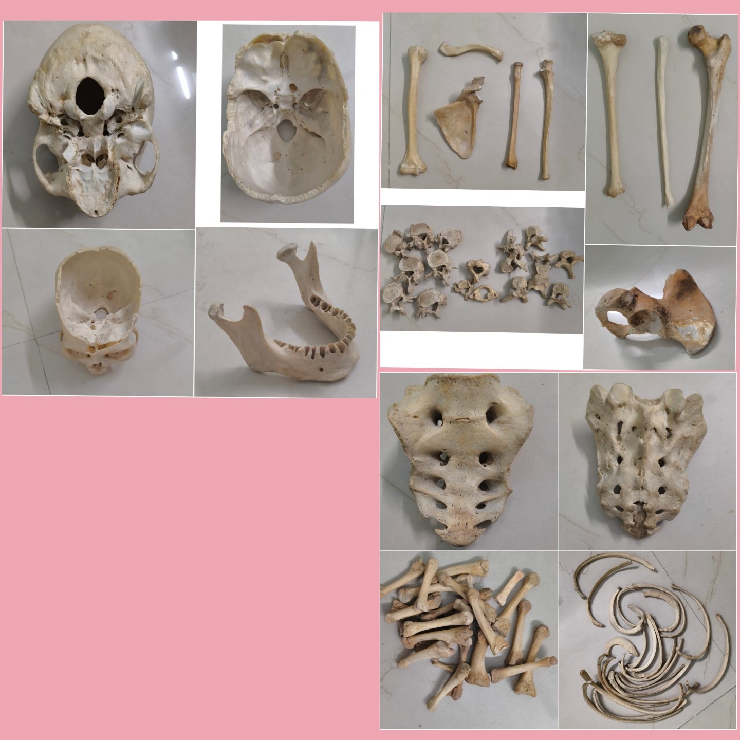 Unilateral Bone set with all necessary bones
