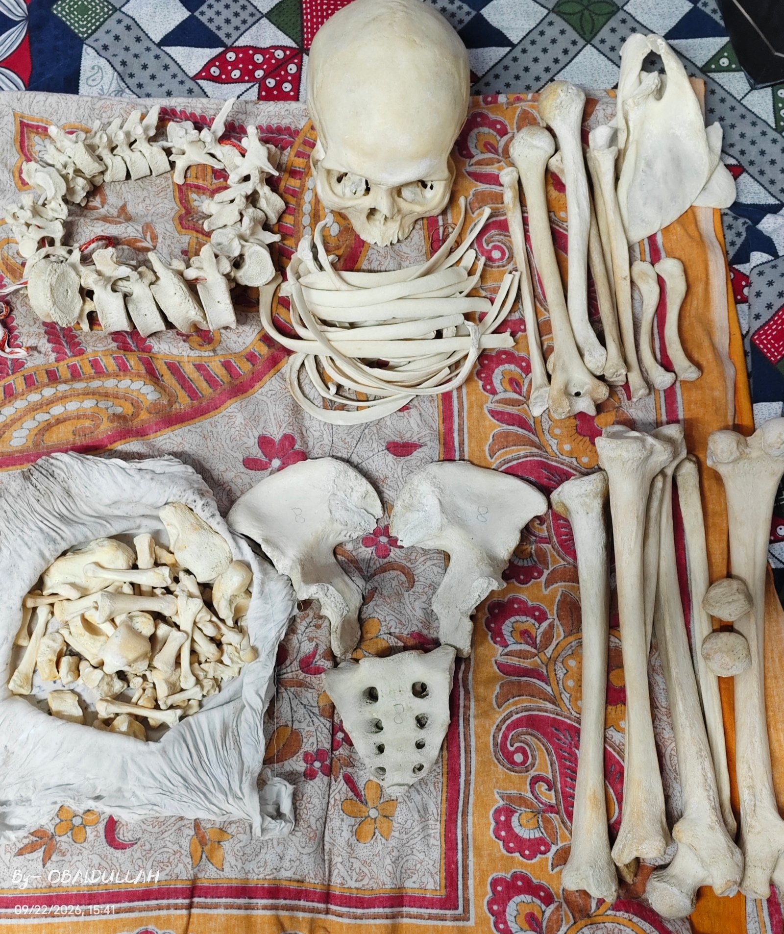 Complete Bilateral Boneset with separate hand and foot bones.