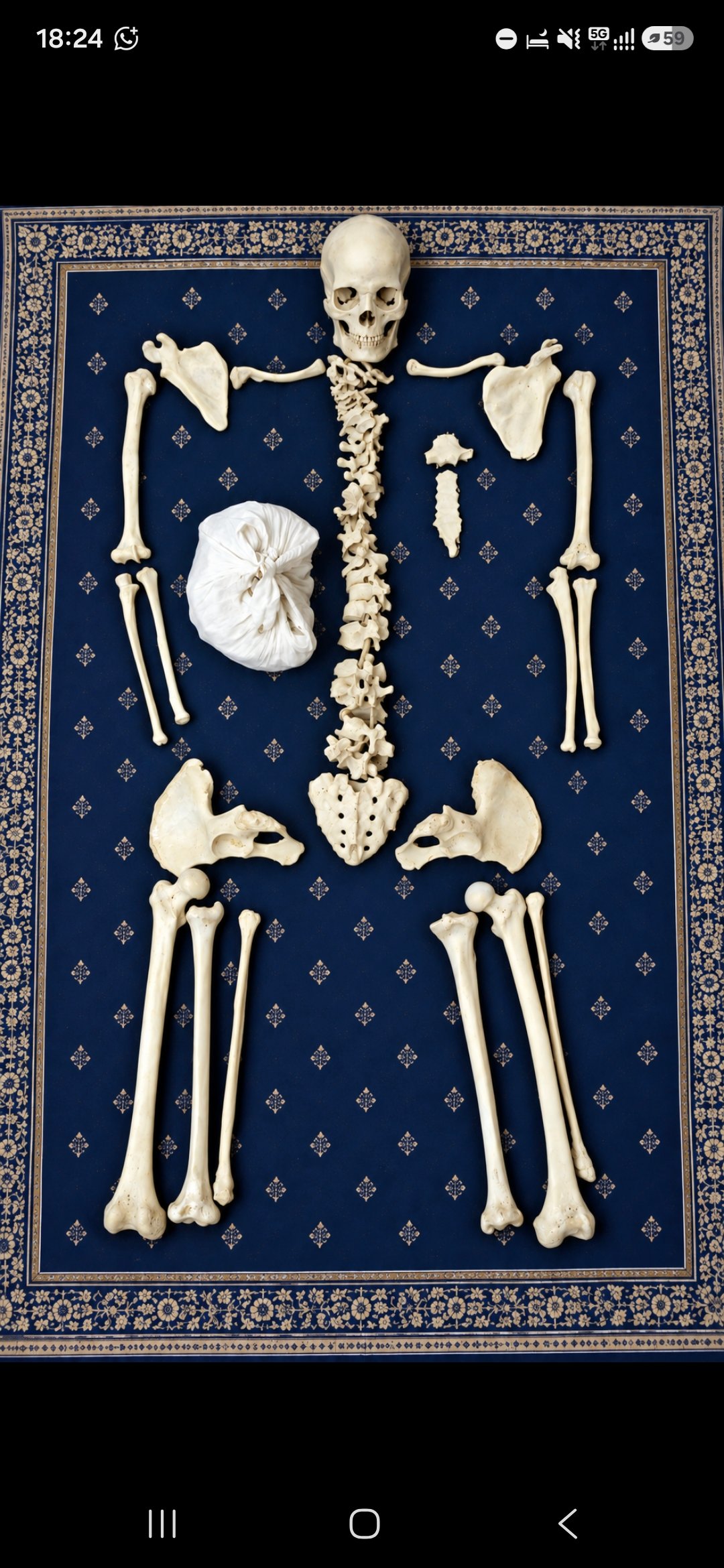 Complete bone set bilateral brand new