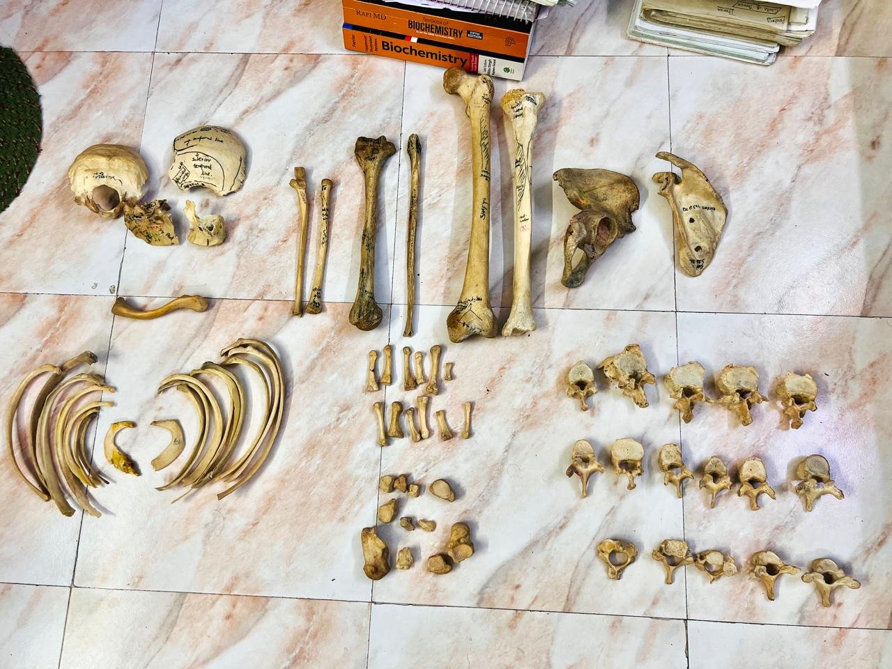 Complete Unilateral bone set