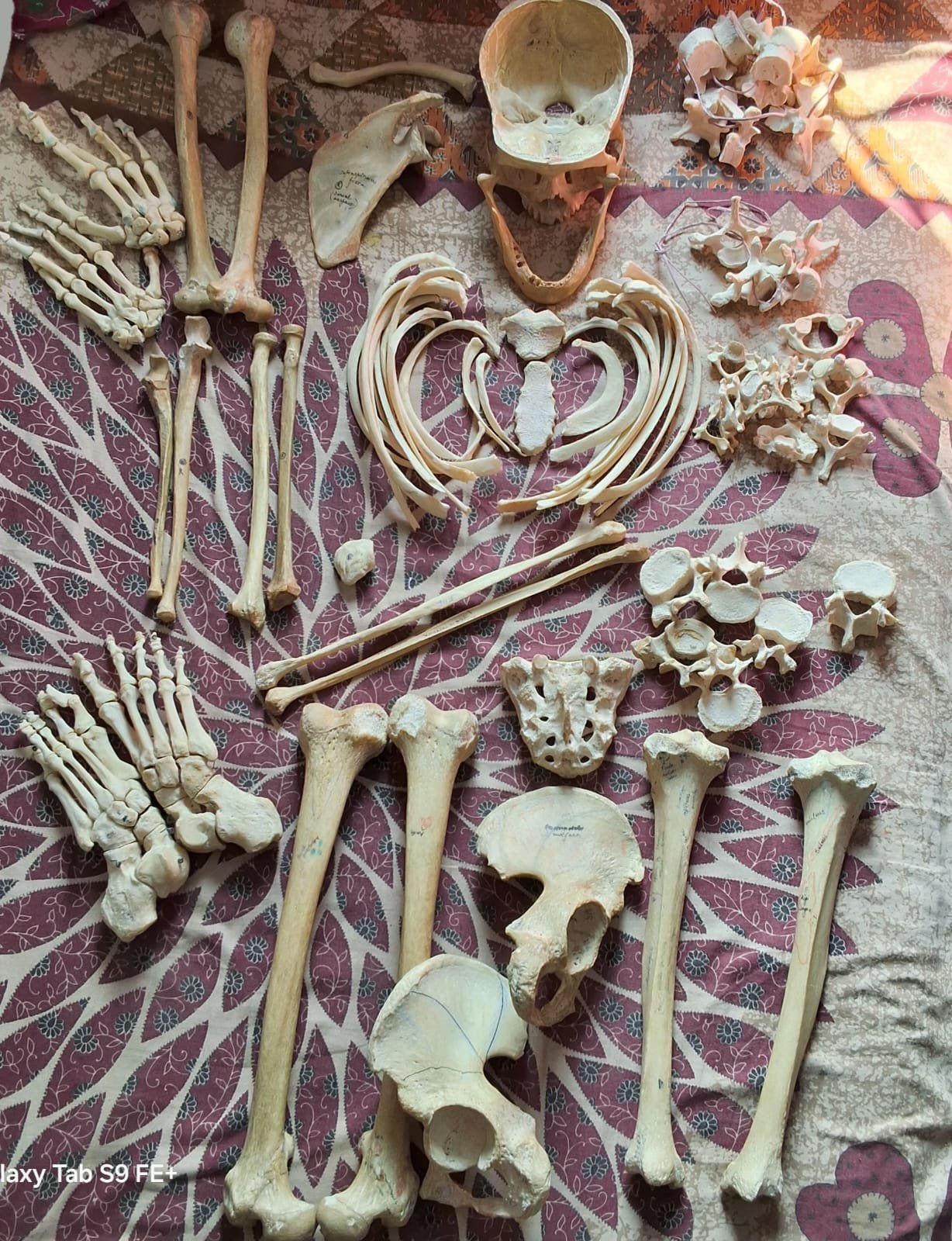 Bilateral bones with base of skull Articulated hand ,foot