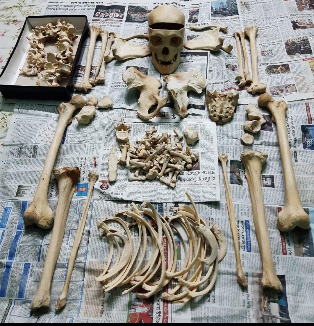 Complete Bilateral Boneset